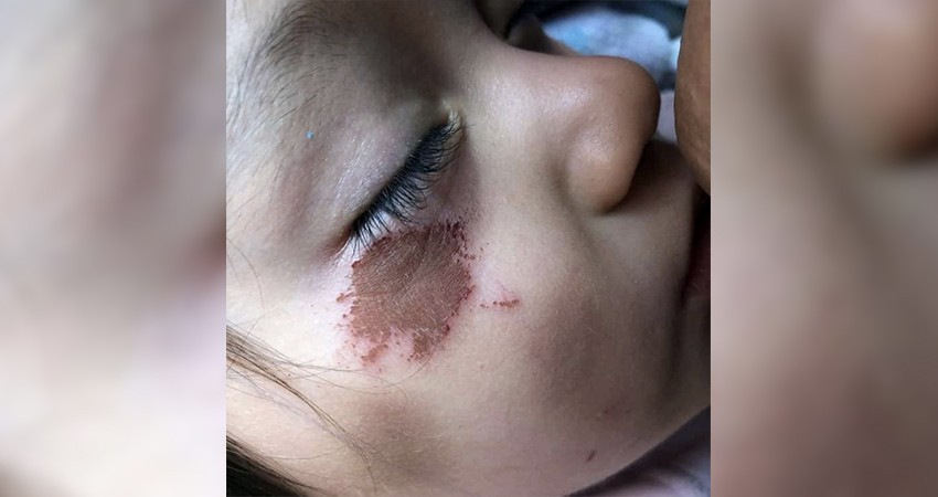 Denuncian a la estancia infantil “Mundo Rey 2” por maltrato infantil