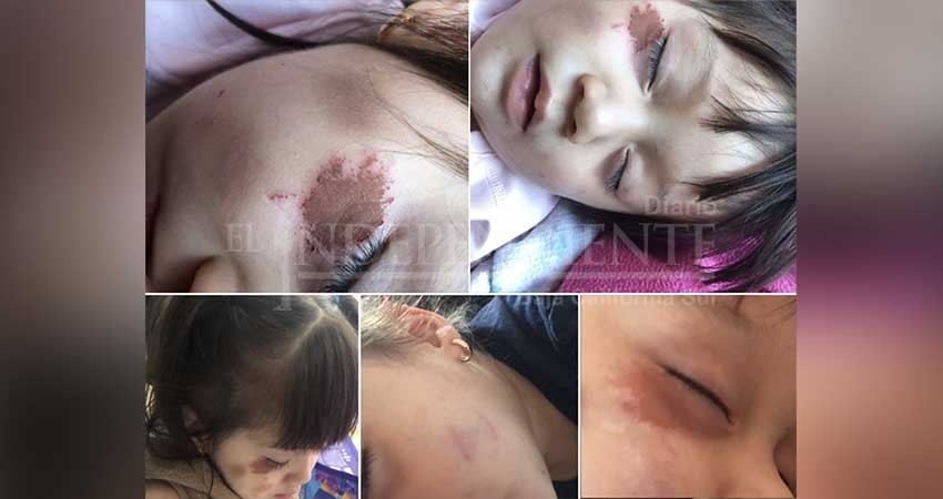 Teme padre de menor agredida en guardería que se desestime su denuncia