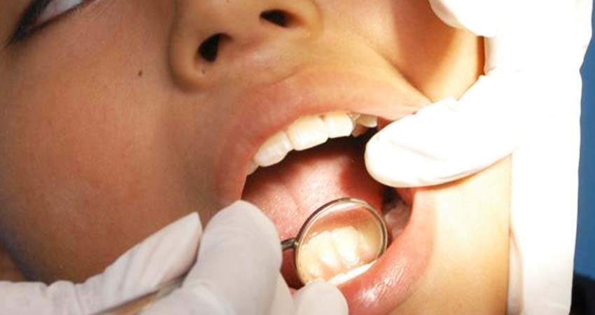 Fumar, mala higiene y sexo sin protección pueden provocar cáncer en la boca, alerta IMSS