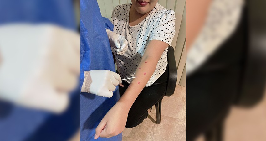 La totalidad de casos confirmados por Mpox en BCS cursan la enfermedad sin complicaciones