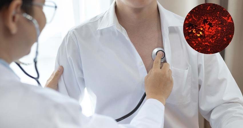 Casos de tosferina en México suman 618 en lo que va de 2025