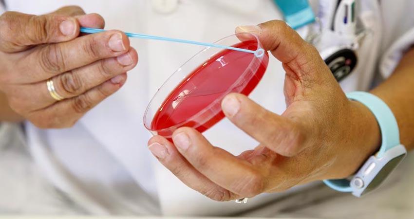 Estudio de laboratorio descarta caso adicional de sarampión en BCS