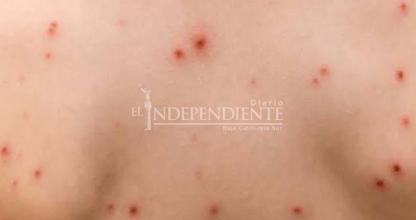 Llama SSA a la población para que acuda a jornadas de vacunación contra el sarampión